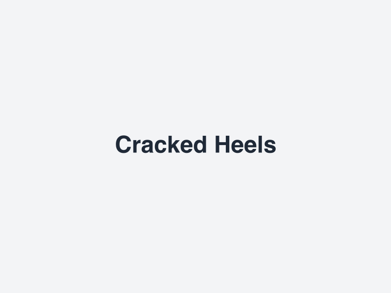Cracked Heels